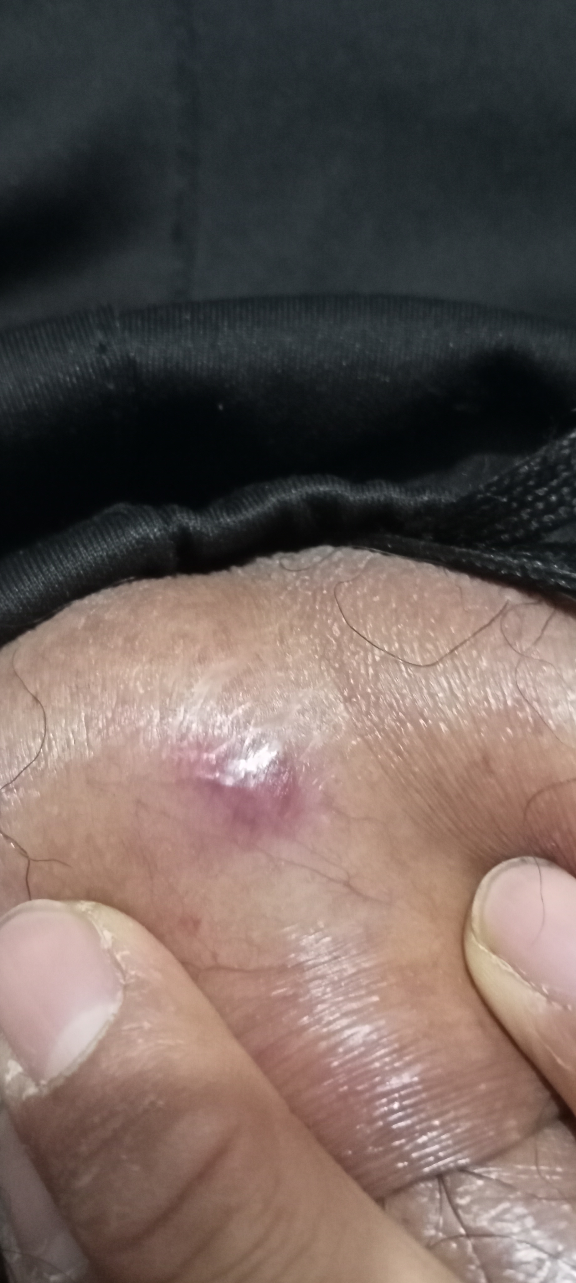 IMG20231125200743.jpg