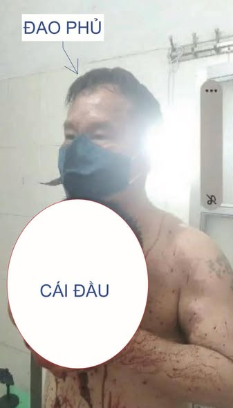 1764168993642.png